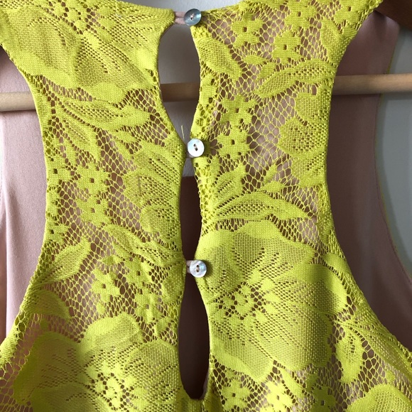 Yellow lace midi dress - Picture 2 of 3